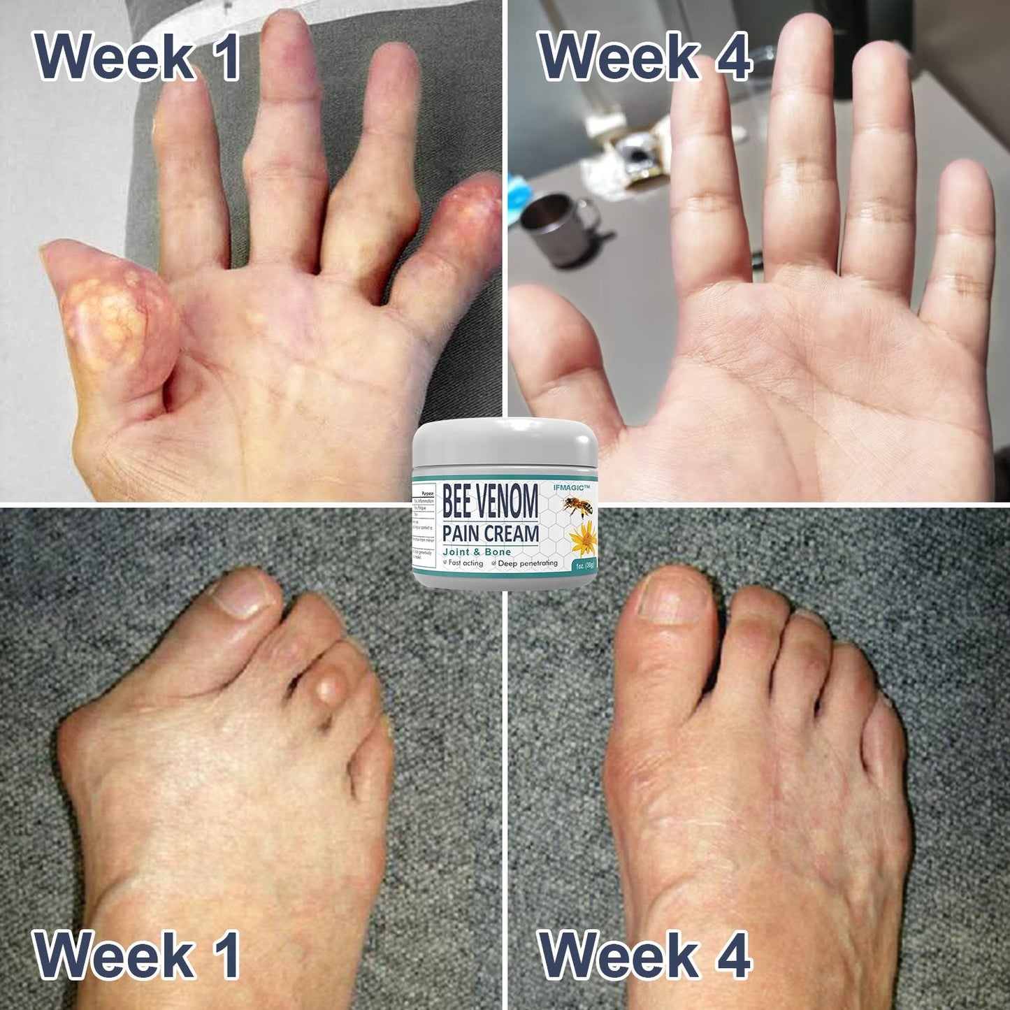 Bee Venom Pain and Bone Healing Cream