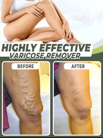 Varicose Veins Healing Patch