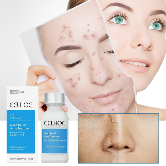 EELHOE™ Dark Spot and Acne Treatment Lotion